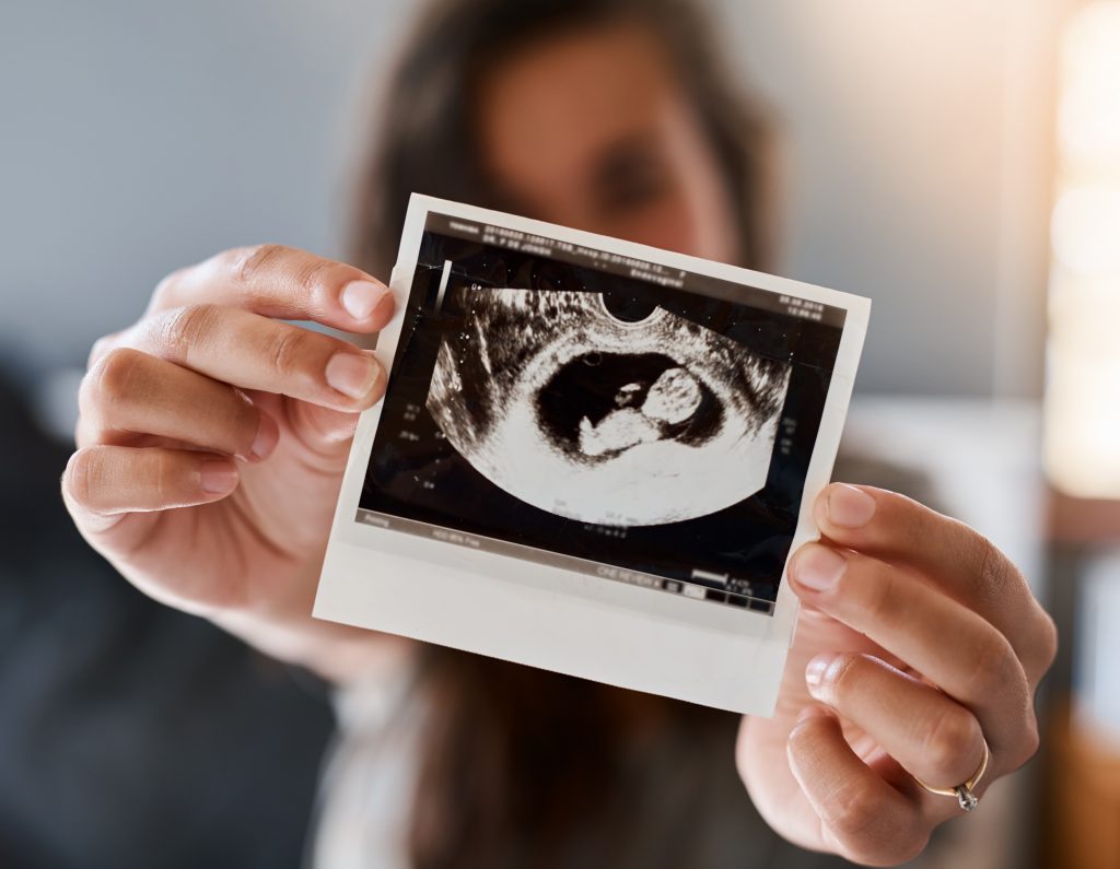 Will you add ultrasounds to your pregnancy memory book? Follow these tips for more ideas.
